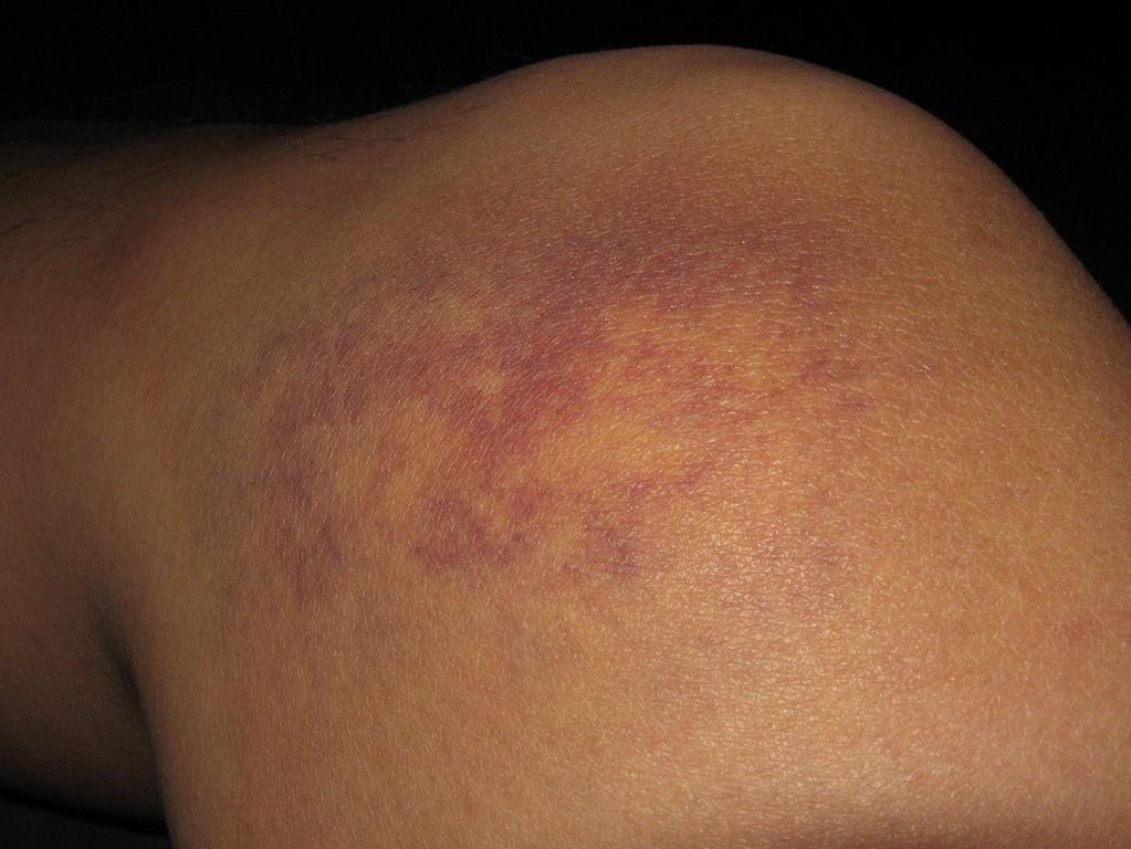 22704-1552008515844.jpg