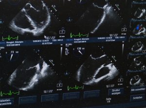 ultrasound-509396-300x222.jpg
