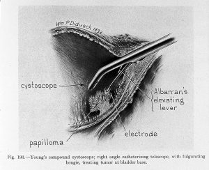 Youngs_compound_cystoscope_by_W.P._Didusch_1932._Wellcome_L0011437-300x244.jpg