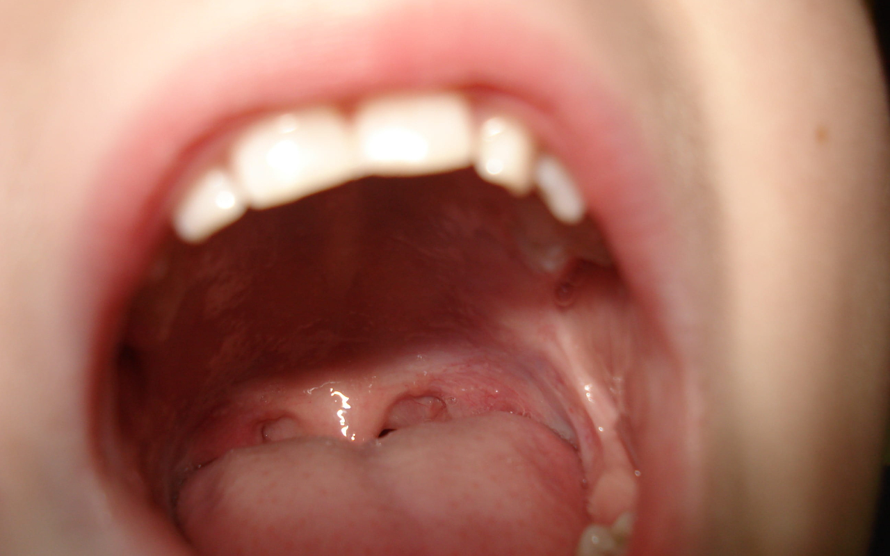 Awkward Visits To The Doctor facts